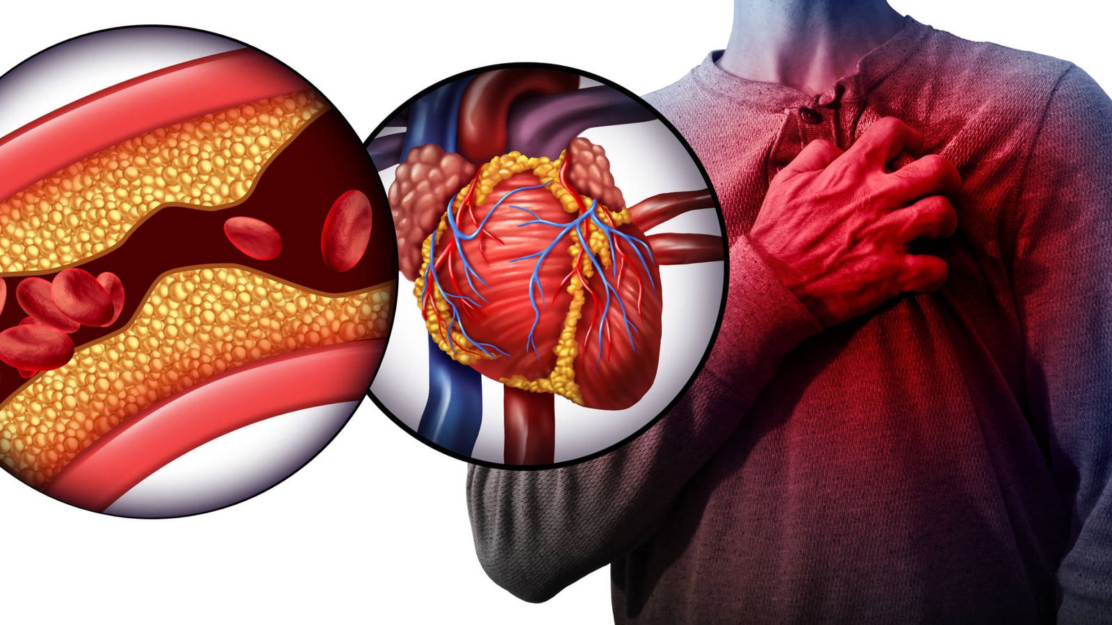 Cómo afecta al corazón el colesterol