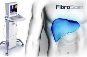 FibroScan mide la rigidez del hígado