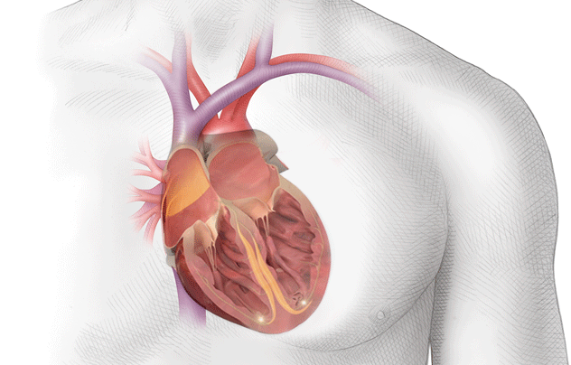 "Fibrilación Auricular: La arritmia cardíaca que afecta las aurículas y puede desencadenar problemas graves en el corazón"