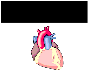 Taquicardia ventricular