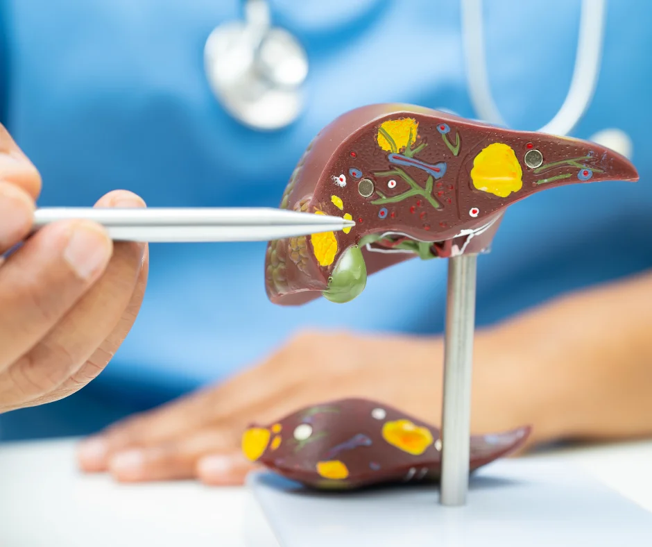 cirrosis