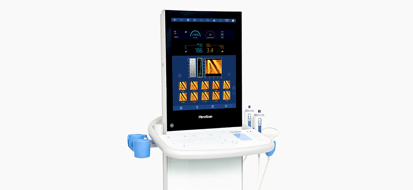 FibroScan