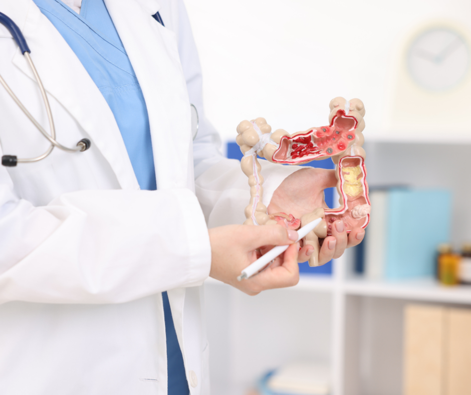 Enfermedad Inflamatoria Intestinal